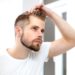 How to Say Goodbye to Hair Loss
