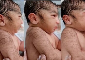 The Hairy Baby: Understanding Infant Hair Growth