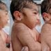 The Hairy Baby: Understanding Infant Hair Growth