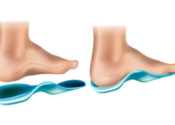 Maximize Comfort with Arch Support Shoes