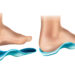 Maximize Comfort with Arch Support Shoes